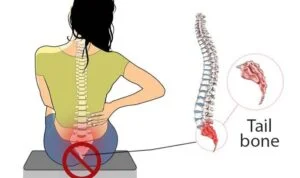 Tailbone pain: Causes, diagnosis, and relief